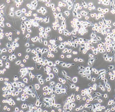 小鼠骨髓树突状细胞(成熟DC细胞),Mouse bone marrow dendritic cells