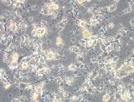 小鼠脊髓成纤维细胞,Mouse spinal cord fibroblasts