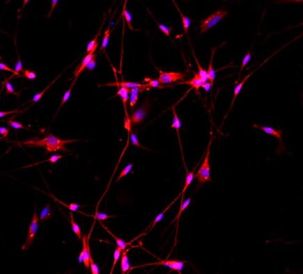 小鼠背根神经元细胞,Mouse dorsal root neurons