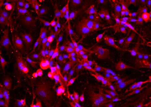 小鼠海绵体内皮细胞,Mouse cavernous endothelial cells