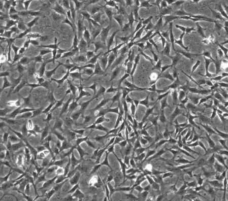 小鼠脊髓神经元细胞,Mouse spinal cord neurons