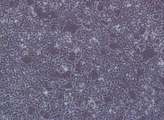 小鼠前列腺成纤维细胞,Mouse prostate fibroblasts