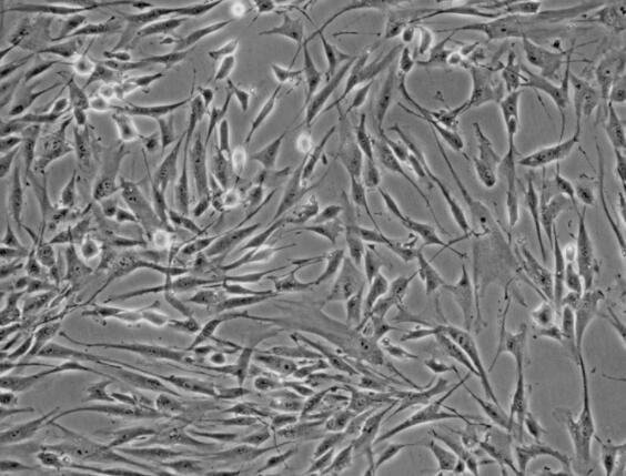 小鼠乳腺成纖維細(xì)胞,Mouse mammary fibroblasts