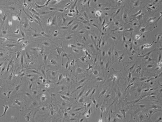 小鼠视乳头星形胶质细胞,Mouse optic papilla astrocytes