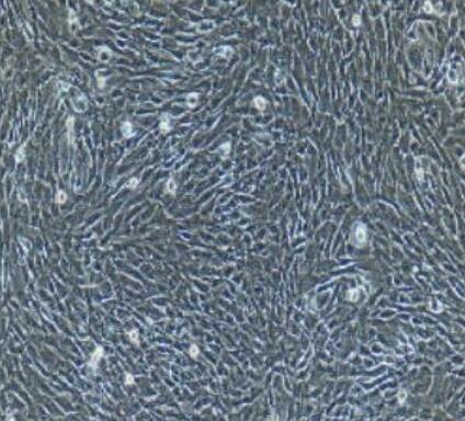 小鼠视网膜前体细胞,Mouse retinal precursor cells