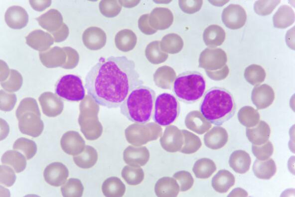小鼠外周血来源内皮祖细胞,Mouse peripheral blood derived endothelial progenitor cells