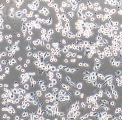 小鼠外周血树突状细胞(成熟DC细胞),Mouse peripheral blood dendritic cells