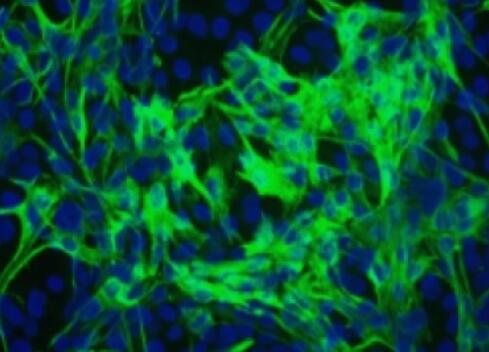 小鼠牙周膜成纖維細(xì)胞,Mouse periodontal ligament fibroblasts