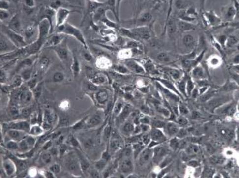 小鼠脂肪细胞,Mouse adipocyte