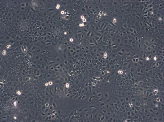 小鼠子宮內(nèi)膜基質(zhì)細(xì)胞,Mouse endometrial stromal cells