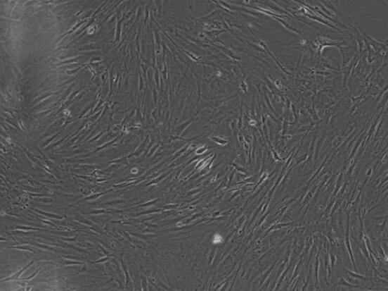 小鼠主動(dòng)脈外膜成纖維細(xì)胞,Mouse adventitia fibroblasts