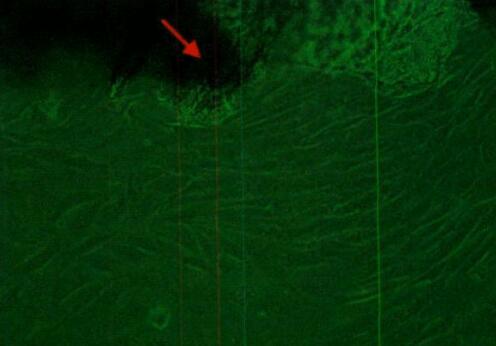 小鼠下颌骨成纤维细胞,Mouse mandibular fibroblasts