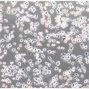 小鼠外周血树突状细胞(成熟DC细胞)