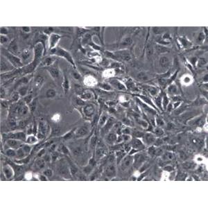 小鼠脂肪细胞,Mouse adipocyte