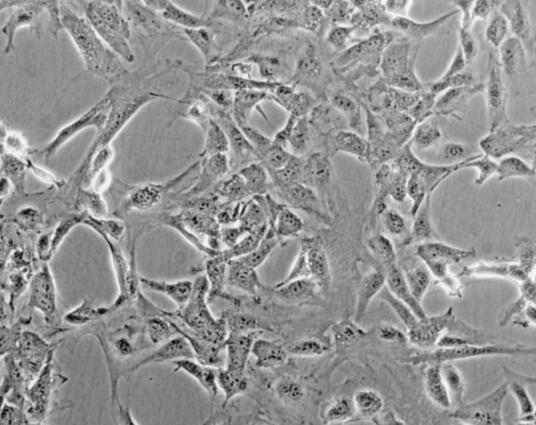 小鼠腦膜成纖維細(xì)胞,Mouse meningeal fibroblasts