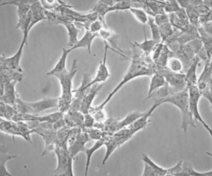 小鼠下丘腦神經(jīng)元細(xì)胞,Mouse hypothalamic neurons