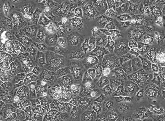小鼠肝非实质细胞,Mouse liver nonparenchymal cells