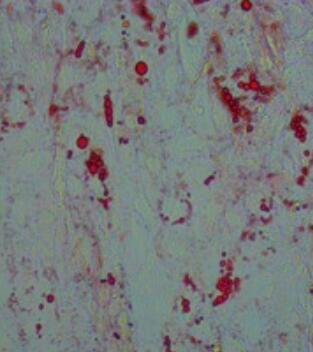 豬脂肪間充質(zhì)干細胞,Porcine adipose derived mesenchymal stem cells