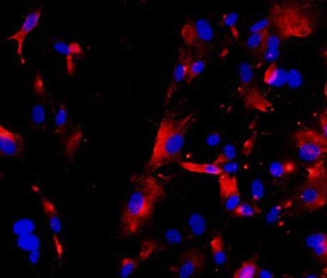 大鼠Ⅱ型肺泡上皮细胞,Rat type Ⅱ alveolar epithelial cells