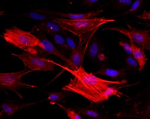 大鼠气管平滑肌细胞,Smooth muscle cells of rat trachea