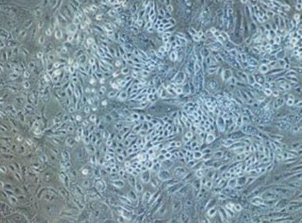 大鼠支气管上皮细胞,Rat bronchial epithelial cells