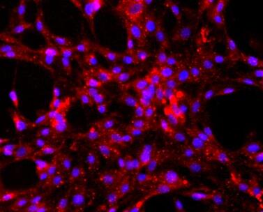 大鼠肺大動(dòng)脈內(nèi)皮細(xì)胞,Rat pulmonary artery endothelial cells