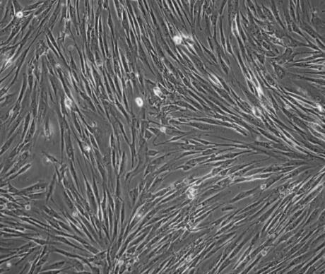 大鼠肺大靜脈內(nèi)皮細胞,Rat pulmonary vein endothelial cells