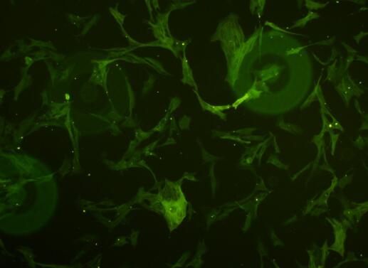 大鼠胰腺星状细胞,Rat pancreatic stellate cells