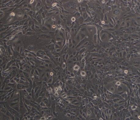 大鼠胰腺上皮细胞,Rat pancreatic epithelial cells