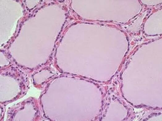大鼠甲状腺滤泡上皮细胞,Thyroid follicular epithelial cells of rats