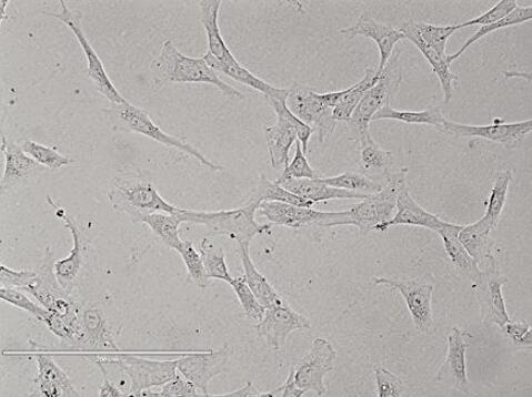 大鼠食管上皮细胞,Rat esophageal epithelial cells