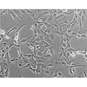 小鼠腦膜成纖維細(xì)胞,Mouse meningeal fibroblasts