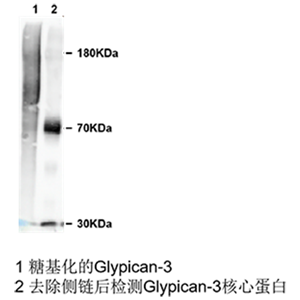 glypican 3小鼠单抗；Anti-Glypican 3 antibody; GPC3 