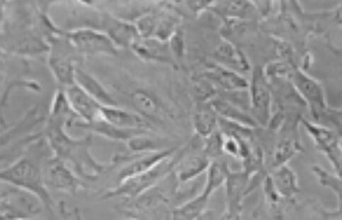 大鼠肝动脉平滑肌细胞,Rat hepatic artery smooth muscle cells