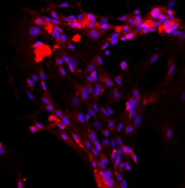 大鼠肝窦内皮细胞,Rat sinusoidal endothelial cells