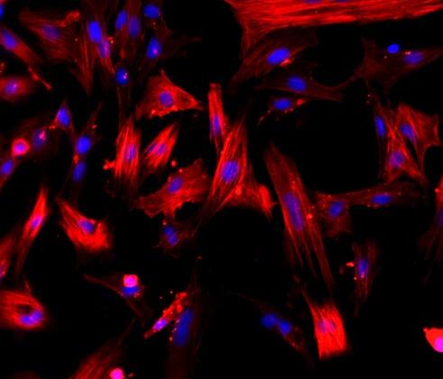 大鼠肝星狀細(xì)胞,Rat hepatic stellate cells