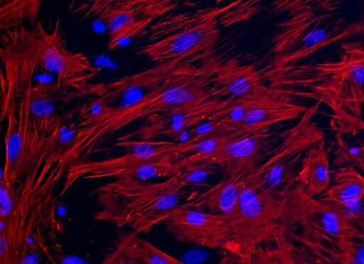 大鼠子宫平滑肌细胞,Rat uterine smooth muscle cells