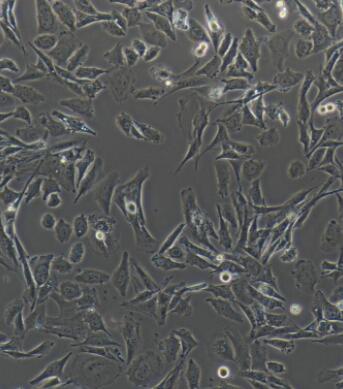 大鼠腎小球系膜細(xì)胞,rat glomerular mesangial cells