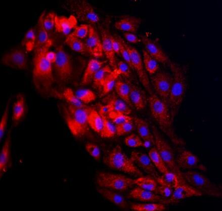 大鼠肾小管上皮细胞,Rat renal tubular epithelial cells