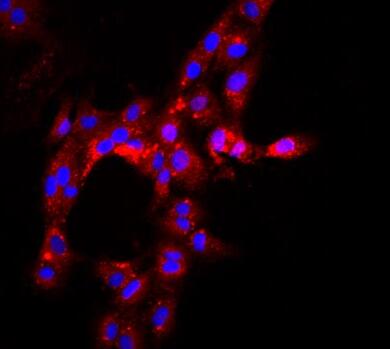 大鼠肾小球内皮细胞,Rat glomerular endothelial cells