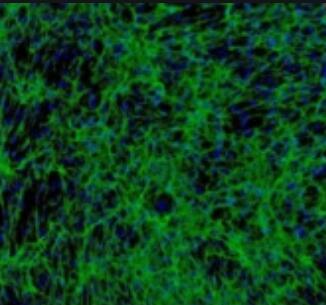 大鼠膀胱成纤维细胞,Rat bladder fibroblasts