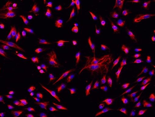 大鼠心肌成纤维细胞,Myocardial fibroblasts of rats