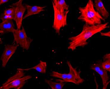 大鼠大隱靜脈平滑肌細(xì)胞,Smooth muscle cells of rat saphenous vein