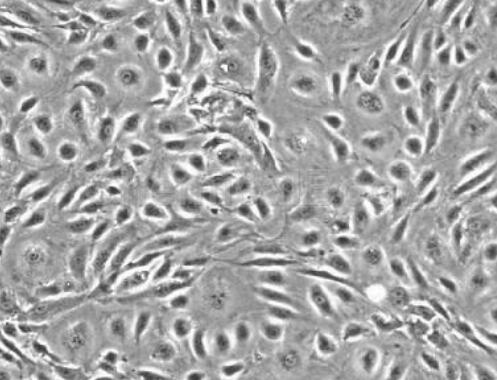 大鼠冠状动脉内皮细胞,Rat coronary artery endothelial cells