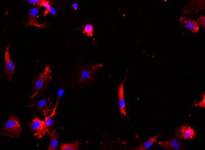 大鼠软骨细胞,Rat chondrocytes