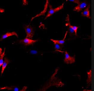 大鼠關(guān)節(jié)軟骨細(xì)胞,Rat articular chondrocytes