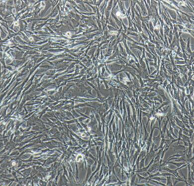大鼠脑动脉血管平滑肌细胞,Smooth muscle cells of cerebral artery in rats