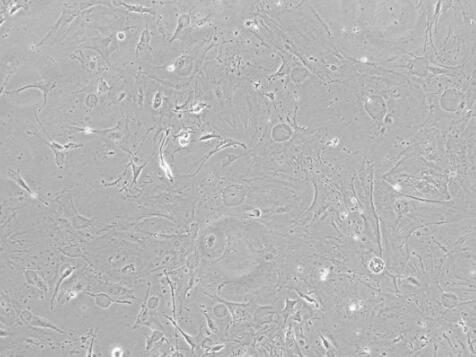 大鼠腦靜脈血管內(nèi)皮細(xì)胞,Rat cerebral vein endothelial cells