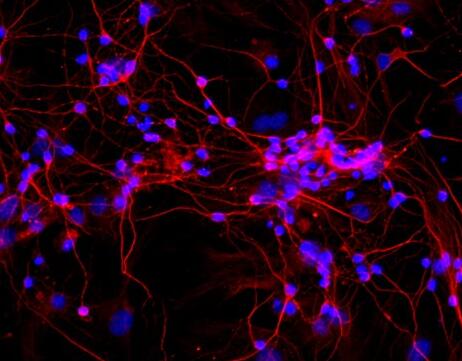 大鼠皮层神经元细胞,Rat cortical neurons