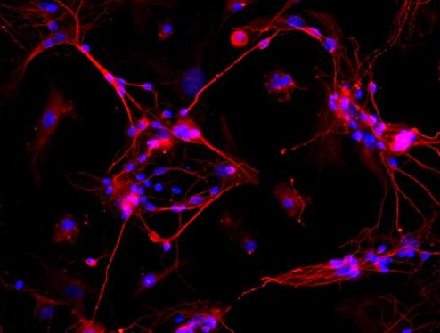 大鼠海马神经元细胞,Hippocampal neurons in rats